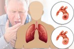 تخصص بیماری های تنفسی در اسپانیا